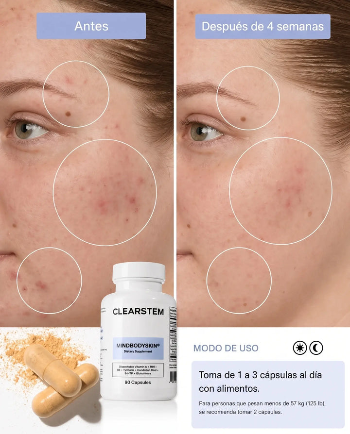 CLEARSTEM® - Combate el acné desde la raíz